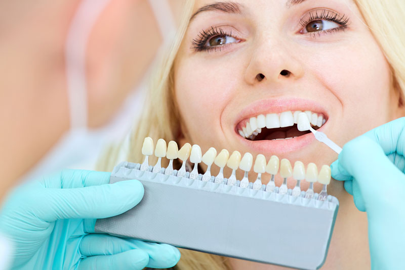 Doctor using color samples to show good result after teeth whitening