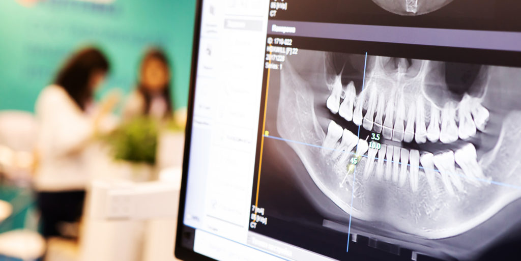 X-ray of the jaw with teeth on a computer monitor. Examination of the oral cavity using digital, medical equipment. Dental treatment in a dental clinic.