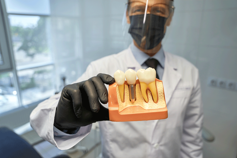 Thinking About The Number Of Dental Implants You Need To Transform Your Smile With Full Mouth Dental Implants In Phoenix, AZ? We Can Help You