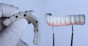 Dental implants in [city],[state] have revolutionized the field of restorative dentistry, offering a reliable and aesthetically pleasing solution for tooth loss. These dental prosthetics function as artificial roots, creating a strong foundation for replacement teeth that look, feel, and work like your natural ones. Apart from the obvious aesthetic advantage, dental implants also play a key role in maintaining oral health. They prevent bone loss in the jaw, maintain the alignment of remaining teeth, and ensure proper bite function. Understanding the Different Types of Dental Implants As dental technology has advanced, several types of dental implants have been developed to cater to different needs and circumstances. Let's delve into the four main ones: endosteal, subperiosteal, zygomatic, and mini dental implants. Endosteal implants are the most used. They're placed directly into the jawbone and usually made of titanium in the shape of small screws. Subperiosteal implants, on the other hand, sit on top of the jawbone but underneath the gum tissue. They're typically utilized when a patient lacks sufficient healthy jawbone for an endosteal implant. Exploring Alternative Dental Implants: Zygomatic and Mini Implants Zygomatic implants are the least common, reserved for cases where the jawbone doesn't have enough quality or quantity for traditional implants. These implants are placed in the cheekbone (zygoma) instead. Lastly, mini dental implants are smaller versions of endosteal implants and are often used for smaller teeth or tight spaces. Each of these choices has its advantages and potential drawbacks. The best one for you depends on various factors such as your oral health condition, bone density, personal preferences, and budget. For instance, while endosteal implants are popular for their strength and reliability, they require good bone density for successful placement. Zygomatic implants, while a viable option for those with inadequate jawbone, involve a more complex surgical procedure. Expert Guidance for Your Dental Implant Journey in [city],[state] Choosing the right type of dental implant is a decision that should be made with the guidance of a dental professional. A thorough examination of your oral health, discussion of your lifestyle and preferences, and understanding of your financial considerations are all essential elements of this process. We specialize in dental implant procedures and are committed to helping you make the best decision for your unique oral health needs. Our team of experienced dental professionals will guide you through the journey, ensuring you understand each step of the process. Smile with Confidence – Schedule Your Consultation Today! We believe that every patient deserves a smile they can be proud of, and we're here to make that a reality for you. Whether you're considering dental implants for the first time or looking for a second opinion, we're here to help. Are you ready to restore your smile with dental implants at our skilled and trusted dental practice? Don't wait to get the smile of your dreams with us. Get in contact with our doctors, Dr._ and our exceptional team at our practice to schedule an appointment today!