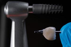 a drill being held up that will place an implant onto the jaw