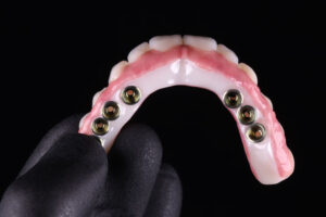 all on 6 dental implants with a full arch of teeth ready to be placed onto the jaw