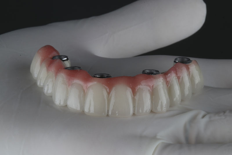 Discover Expert Dental Care: Your Guide to Finding the Best Dentist in Phoenix, AZ