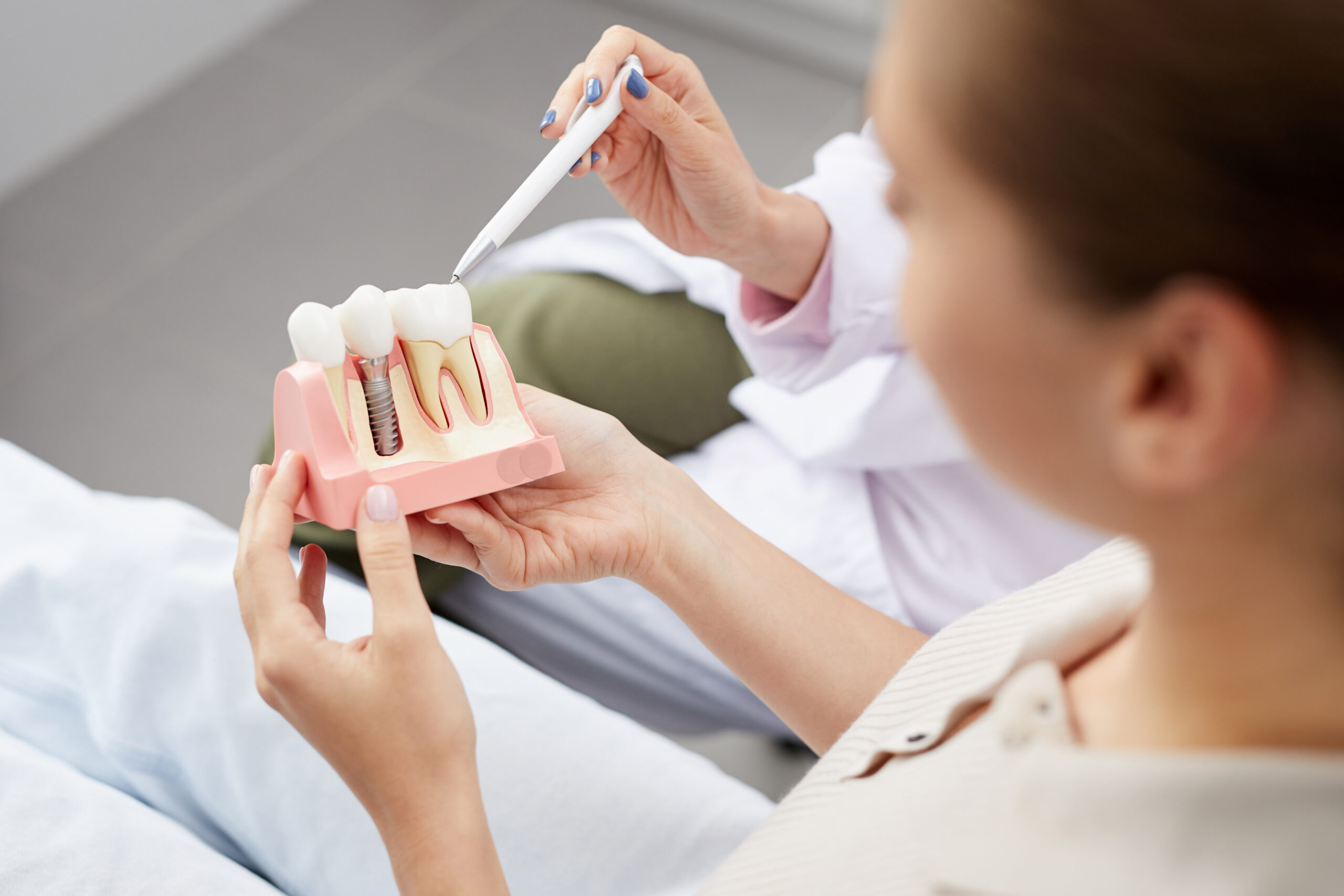 Choosing the Best Phoenix Dental Implants: What You Need to Know