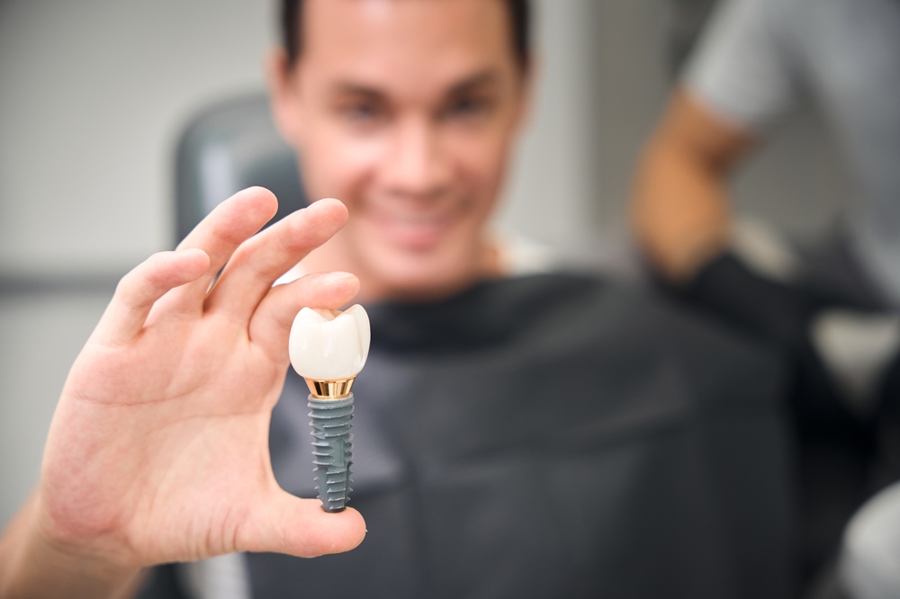 Finding the Best Dental Implants Dentist Near You