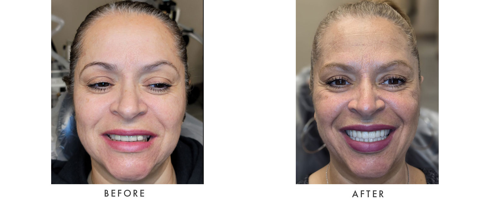 Dental Patient Before and After